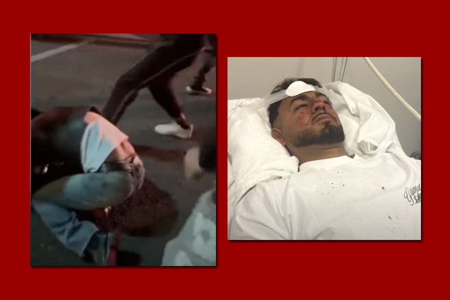 indian-attacked-in-australi ഓസ്ട്രേലിയയിൽ ഇന്ത്യക്കാരനുനേരെ ആക്രമണം.