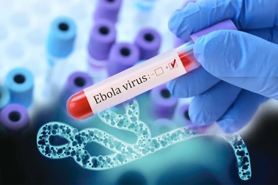 ebola-virus കോംഗോയിൽ അതിമാരകമായ എബോള വൈറസ് പടരുന്നു; ലോകാരോഗ്യ സംഘടന ആരോഗ്യ അടിയന്തിരാവസ്ഥ പ്രഖ്യാപിച്ചു.